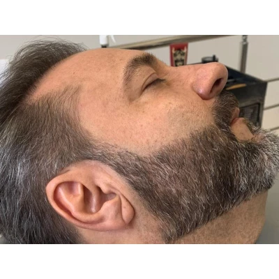 Taubaté: Full Barba (Micropigmentação de Barba)