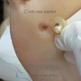 Foto 1:  Lucimeiry Podóloga
