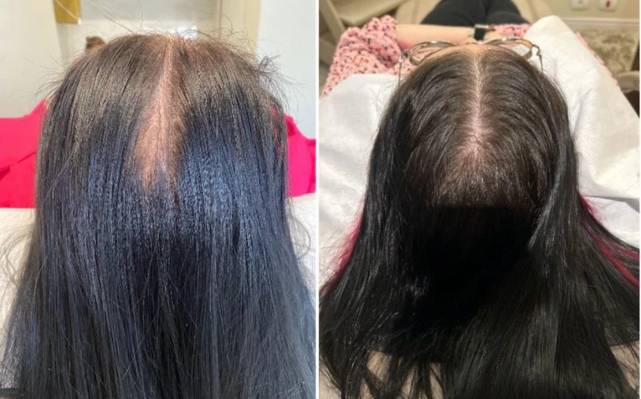 Foto 2:  —  Clínica Dra. Jessica Moreira Saúde e Estética Especializada