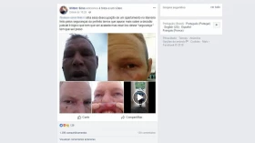 Morador do Barreiro é agredido por funcionário da Prefeitura
