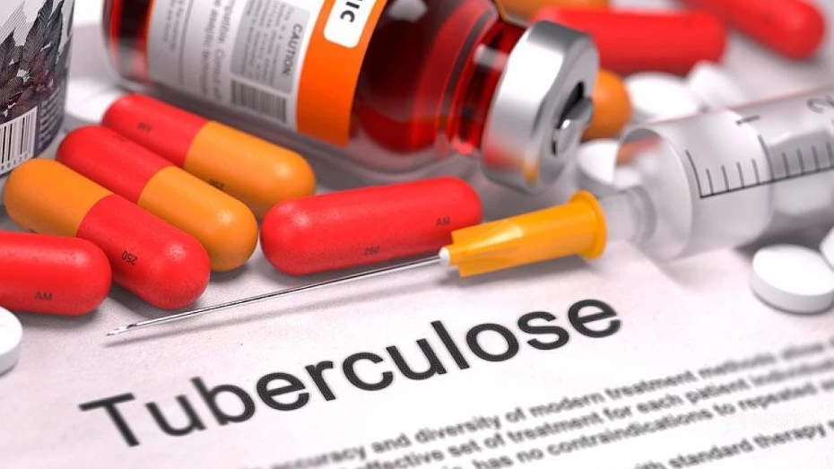  Campanha para intensificar diagnóstico de tuberculose tem início em Taubaté