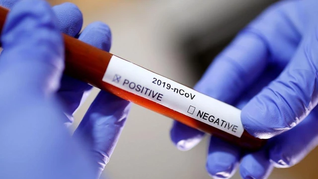 Taubaté registra 428 novos casos e 15 óbitos por Covid-19 no mês de junho