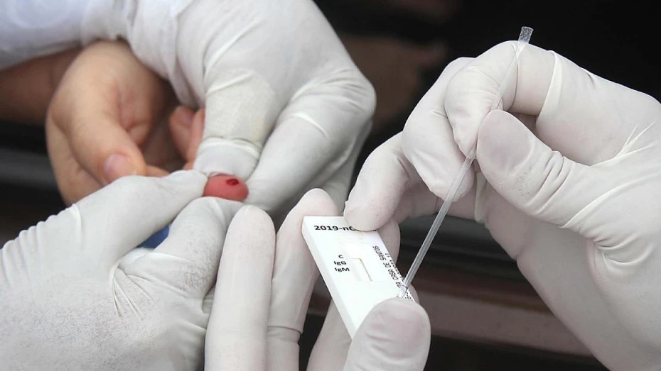 Mais dois casos de Covid-19 são registrados no Bom Prato e na Rodoviária Velha
