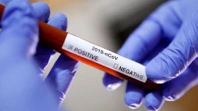 Taubaté registra 12 mortes por Covid-19 em apenas 4 dias