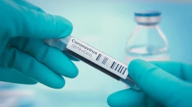 Taubaté atinge marca de 3.000 casos confirmados de Covid-19