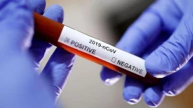 Pinda realiza teste gratuito de Coronavírus