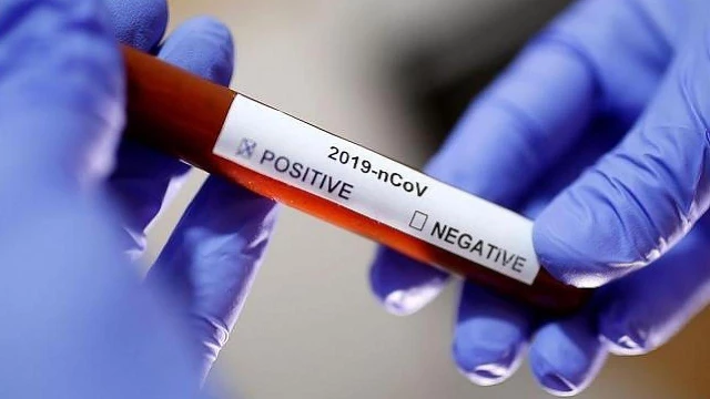 Pinda realiza teste gratuito de Coronavírus