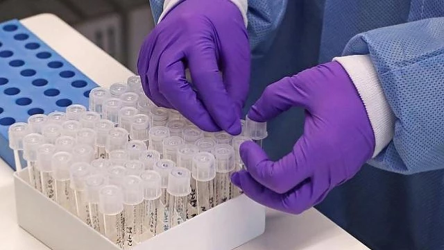 Boletim: Taubaté confirma 50 novos casos de Covid-19
