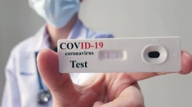 “Termômetro” da Covid fica no limite para mudança de cor em Taubaté