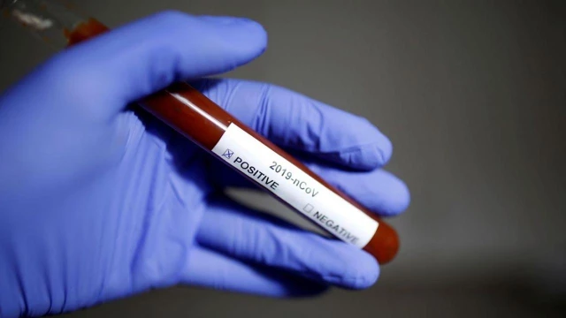 Taubaté ultrapassa marca de 9 mil casos de Covid-19
