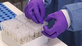 Taubaté chega ao 4º dia sem registro de óbitos por Covid-19