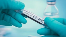 Covid: Taxa de ocupação de leitos de UTI é de 94% Covid: Taxa de ocupação de leitos de UTI é de 94%