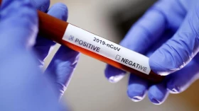 Covid: Taubaté registra mais quatro mortes e 343 novos casos Covid: Taubaté registra mais quatro mortes e 343 novos casos