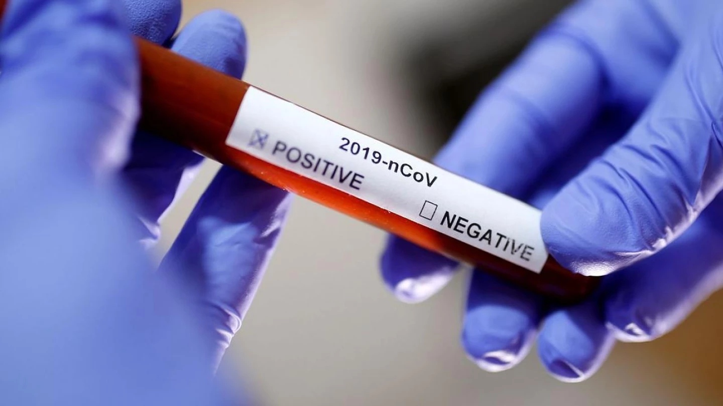 Covid: Taubaté registra mais quatro mortes e 343 novos casos