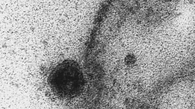 USP: novo coronavírus infecta e se replica em glândulas salivares