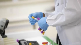 Índices da Covid permanecem sem mudanças consideráveis em Taubaté Índices da Covid permanecem sem mudanças consideráveis em Taubaté