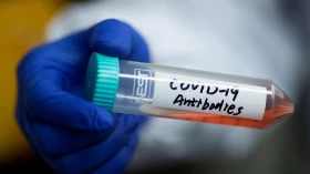 Covid: Taubaté confirma mais 87 casos, sem registro de óbitos