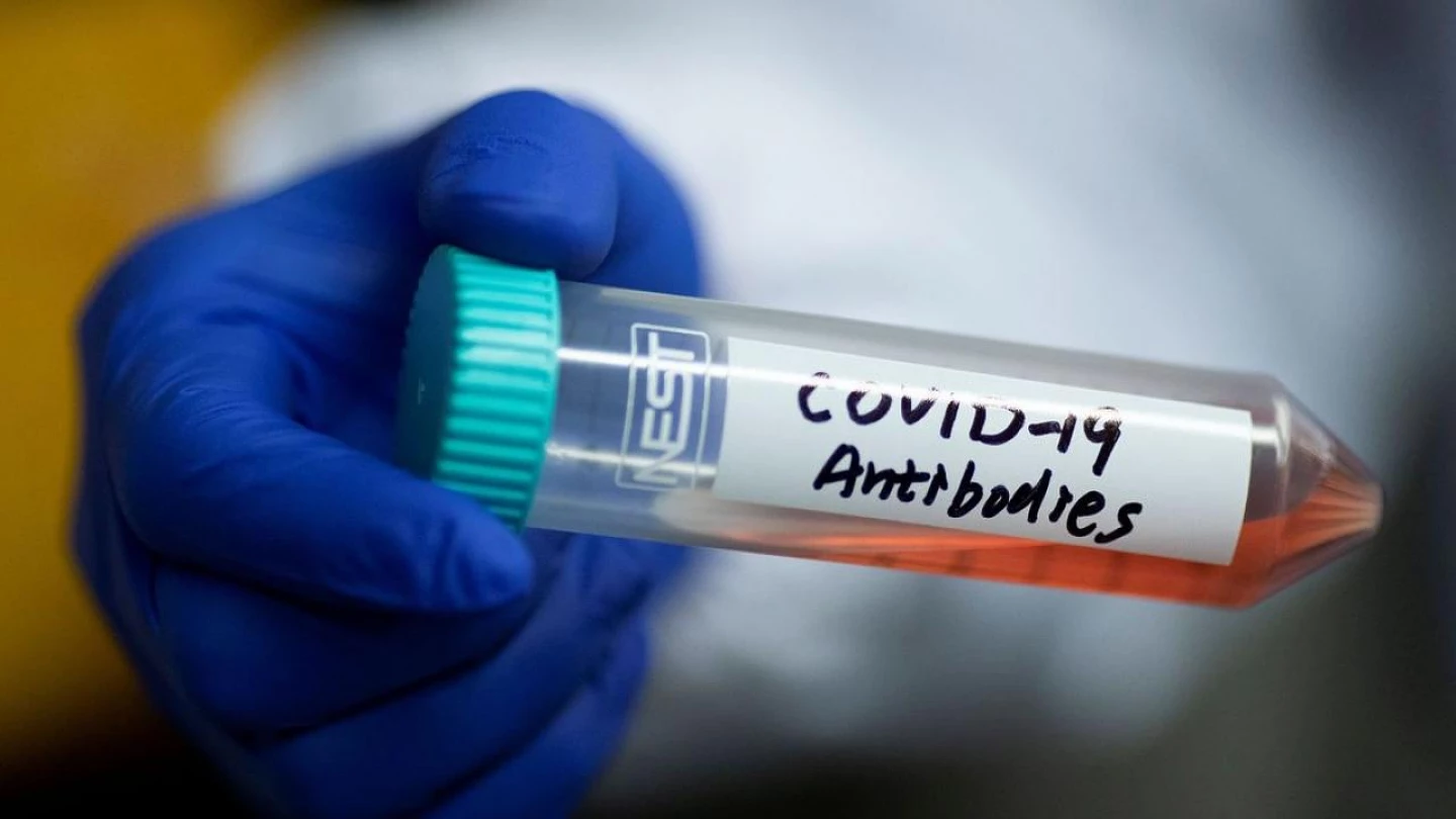 Covid: Taubaté confirma mais 87 casos, sem registro de óbitos