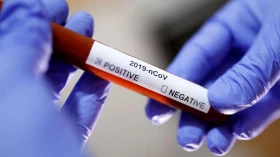 Taubaté confirma mais três mortes e 58 casos positivos de Covid