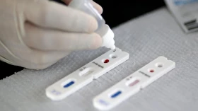 Taubaté irá disponibilizar 3 mil testes rápidos contra Covid-19