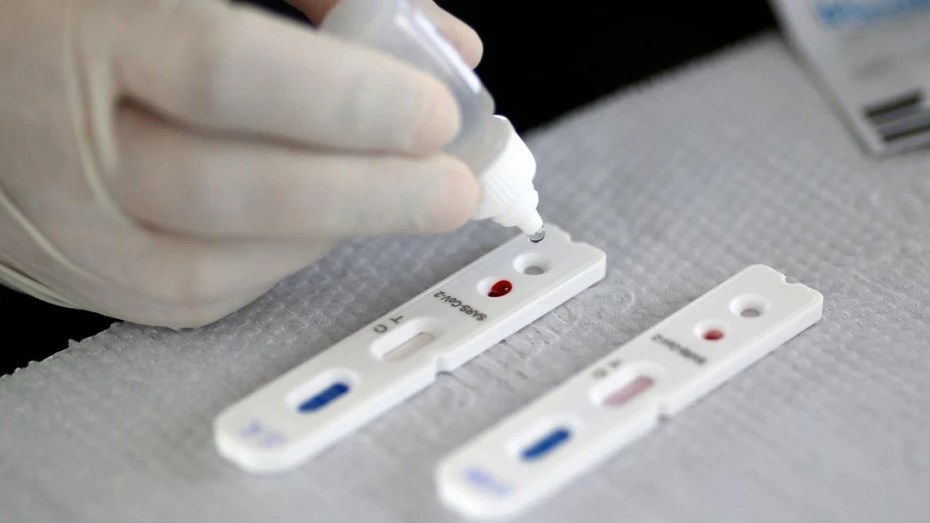 Taubaté irá disponibilizar 3 mil testes rápidos contra Covid-19 Taubaté irá disponibilizar 3 mil testes rápidos contra Covid-19