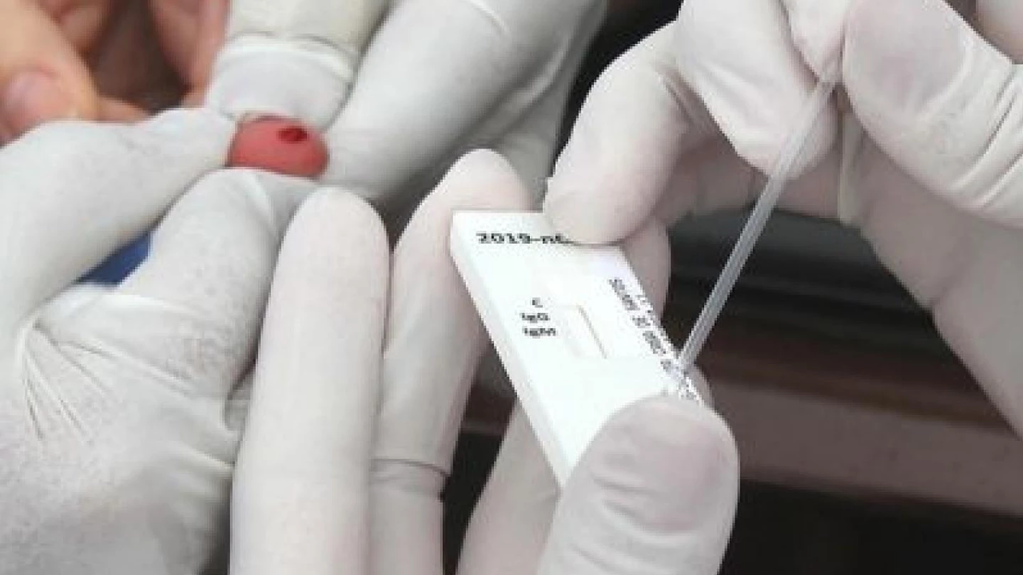 Testes rápidos de Covid-19 são oferecidos em Taubaté