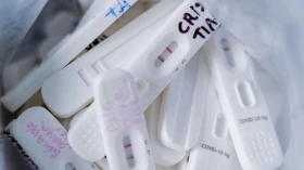 Procon-SP fiscaliza preços abusivos de testes de covid-19