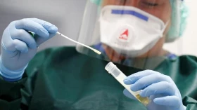 Covid: Taubaté confirma mais dois óbitos e 491 novos casos