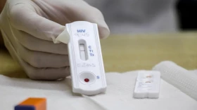 “Fique Sabendo” detecta seis pessoas soro positivas em Taubaté