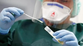 Covid: Taubaté registrou 42 óbitos em 2023