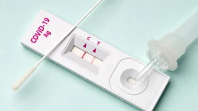 Taubaté realizou quase 50 mil testes de Covid-19 em 2023