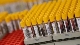 Prefeitura de Taubaté realiza mutirão com 900 exames de análises clínicas por dia