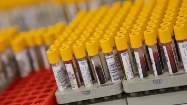 Prefeitura de Taubaté realiza mutirão com 900 exames de análises clínicas por dia