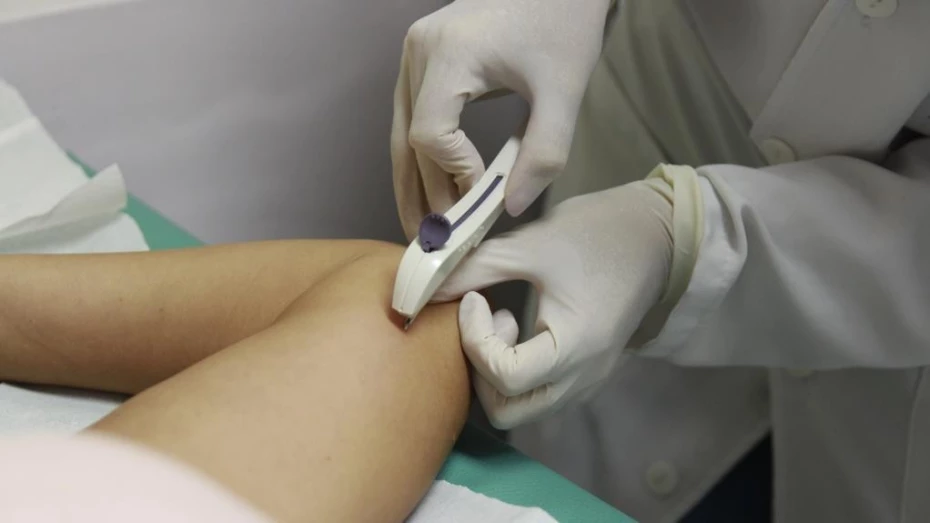 Prefeitura inicia busca ativa entre população de rua para aplicação de implante contraceptivo