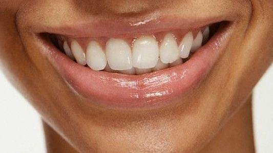 Entendendo as novas regras do Imposto de Renda para profissionais de Odontologia