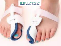 CORRETOR DE JOANETE Mod. HALLUX VALGUS