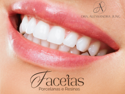 Facetas de Resina e Porcelana