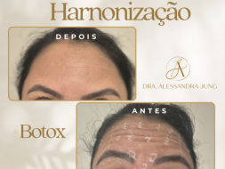 Harmonização Orofacial