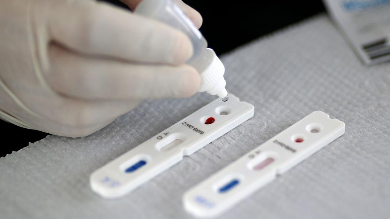 Taubaté irá disponibilizar 3 mil testes rápidos contra Covid-19 Taubaté irá disponibilizar 3 mil testes rápidos contra Covid-19